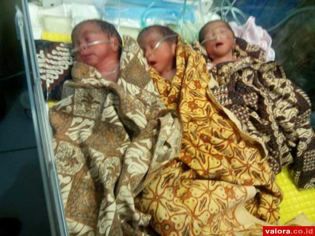 Ibu Muda Asal Sangir Lahirkan Bayi Kembar Tiga